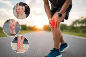 Running Injuries