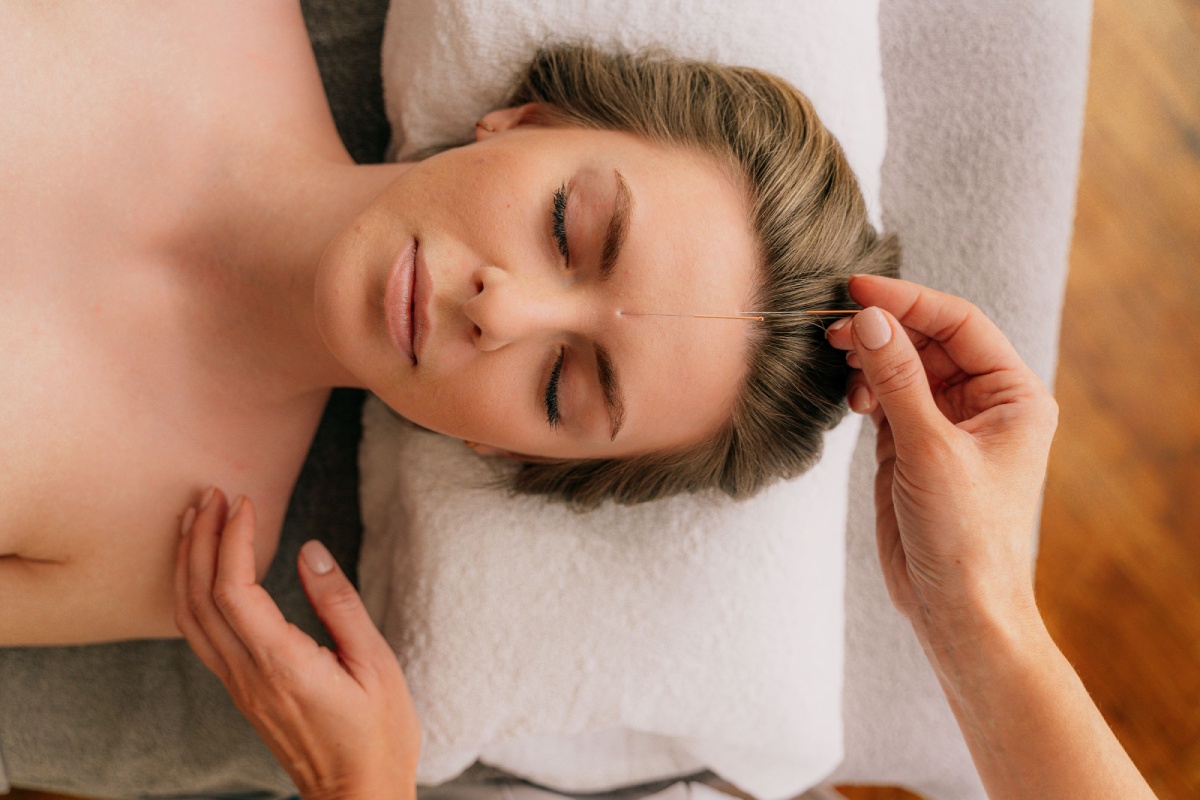 acupuncture for anxiety Chicago