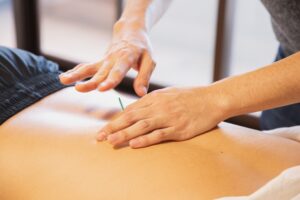 acupuncture for lower back pain Chicago