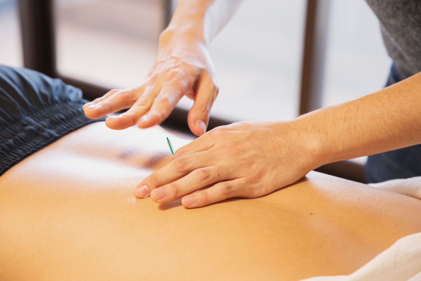 acupuncture for lower back pain Chicago